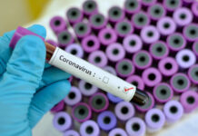 How might the Coronavirus outbreak affect Pakistan’s economy?
