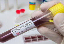 China provides $4m aid, medical equipment to Pakistan